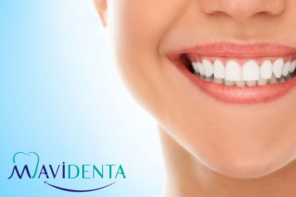 Best Dental Implant Clinic In Istanbul