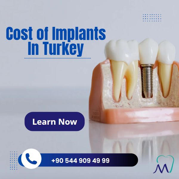 Cost Of Implants In Turkey