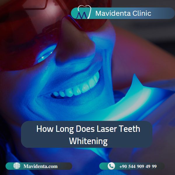 Laser Teeth Whitening Cost In Turkey