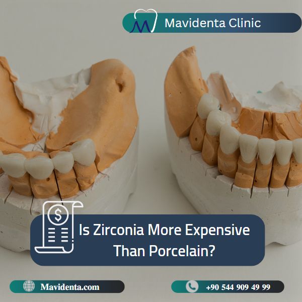 Difference Between Zirconia And Porcelain Crowns .