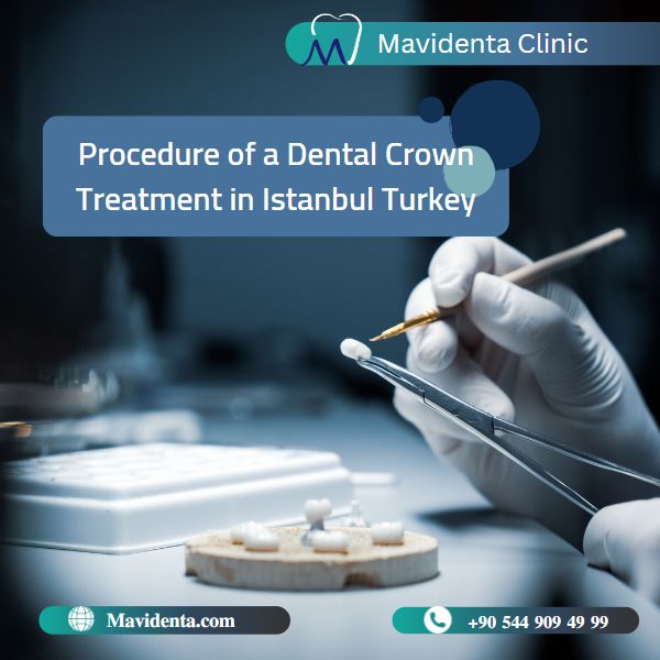 The Best Dentist In Turkey For Crowns