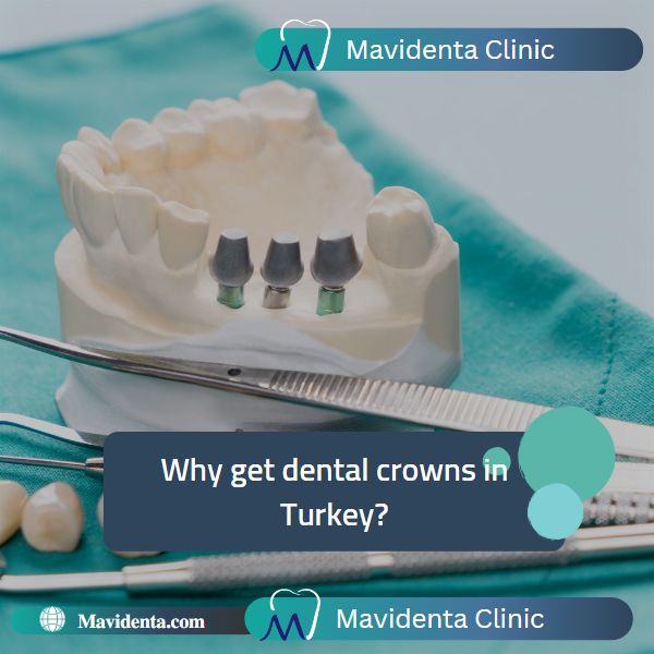 The Best Dentist In Turkey For Crowns