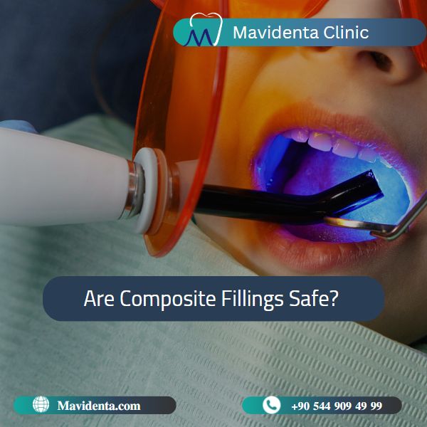 Teeth Composite Filling Cost   