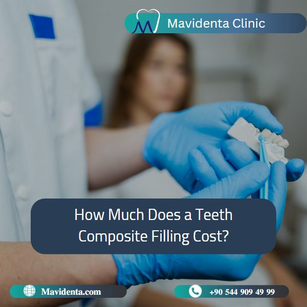 Teeth Composite Filling Cost   