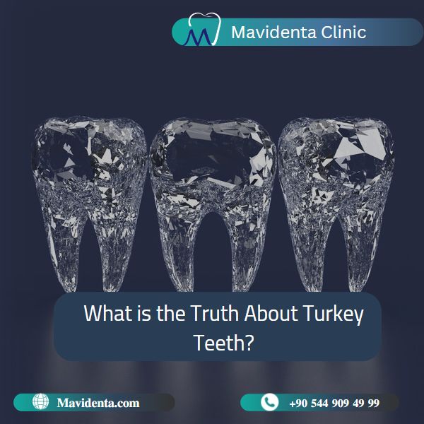 Best Dentists In Istanbul Turkey  