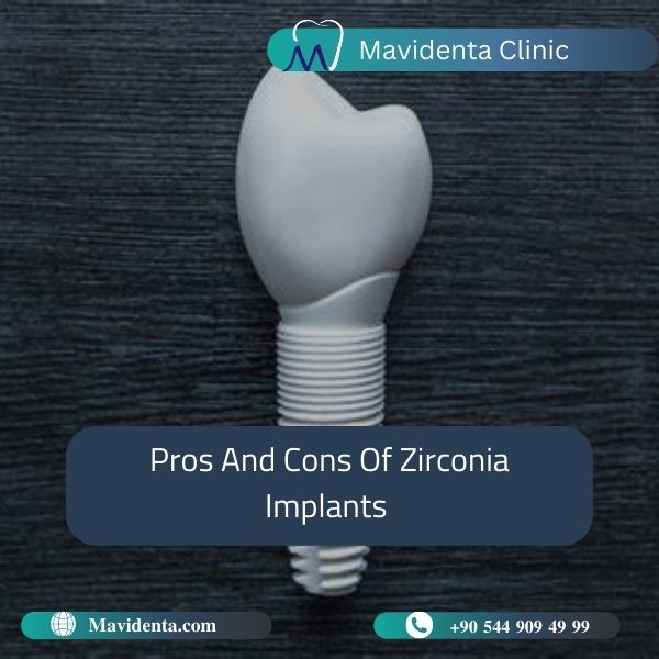 Which Is Better Zirconia Or Titanium Implants  