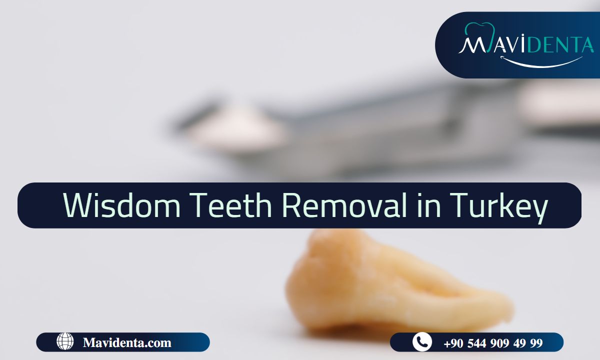 Wisdom Teeth Removal In Turkey Procedure Cost And Benefits