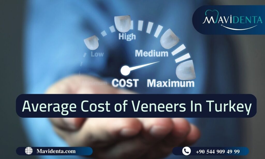 Average Cost of Veneers in Turkey