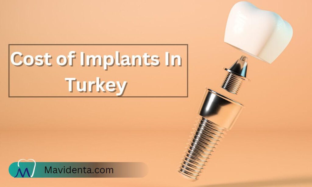Cost Of Implants In Turkey