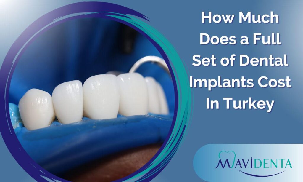 How Much Does a Full Set Of Dental Implants Cost In Turkey