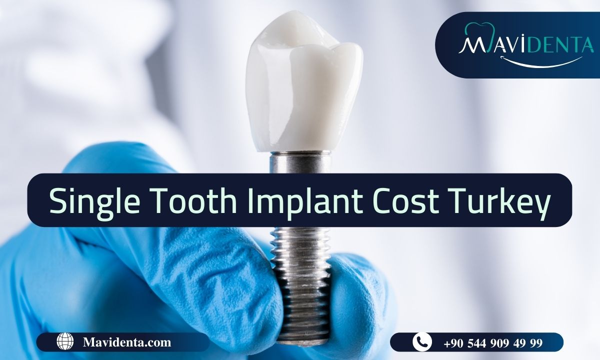 how much tooth implant cost in turkey