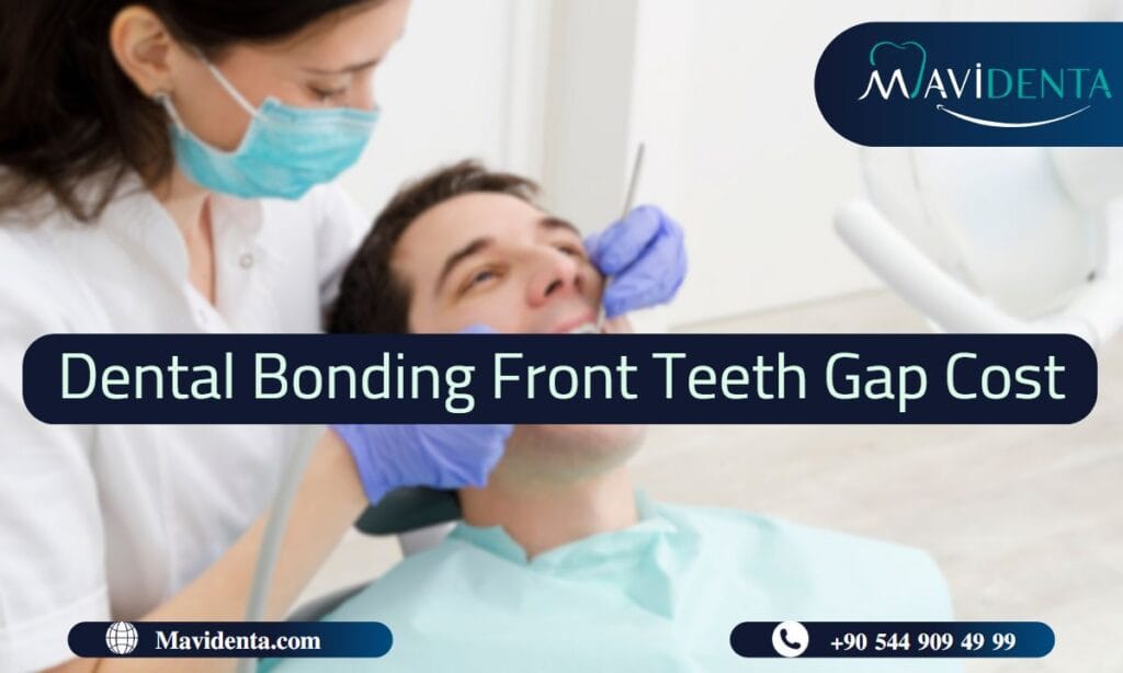 Dental Bonding Front Teeth Gap Cost