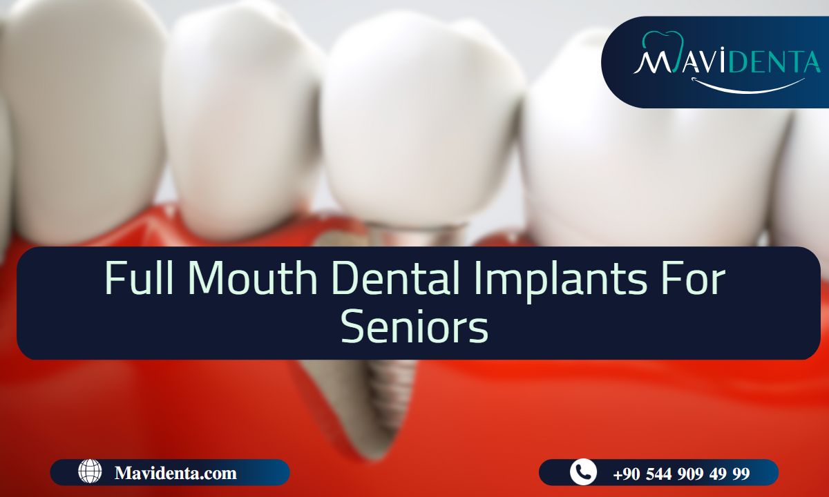 Complete Smile With Full Mouth Dental Implants For Seniors   Full Mouth Dental Implants For Seniors 