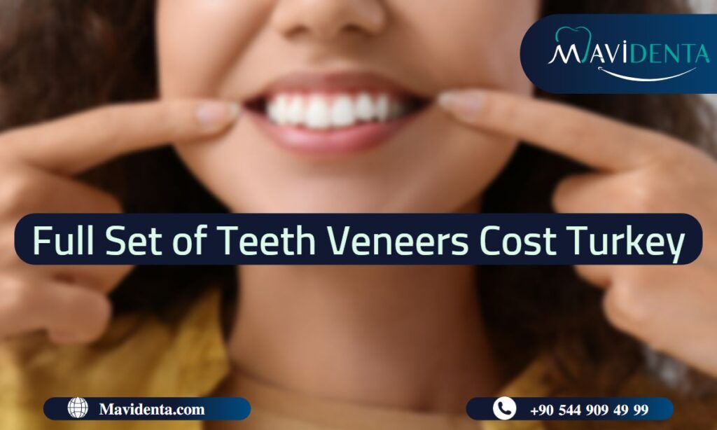 Full Set of Teeth Veneers Cost Turkey