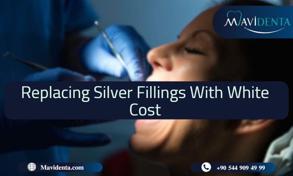 Replacing Silver Fillings With White Cost