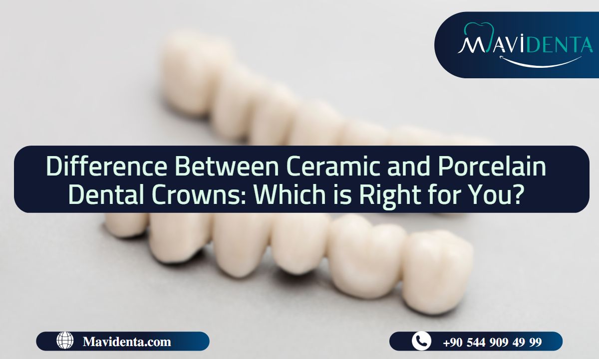 Difference Between Ceramic and Porcelain Dental Crowns
