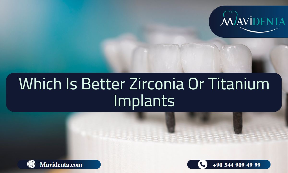 Which Is Better Zirconia Or Titanium Implants  