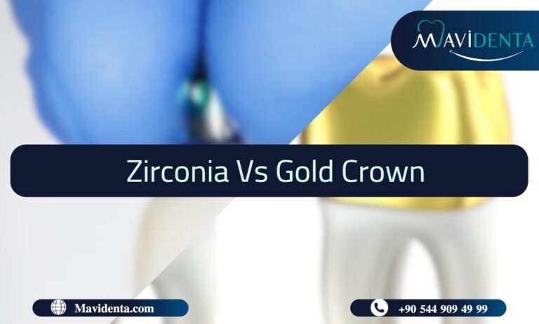 Zirconia vs Gold Crown
