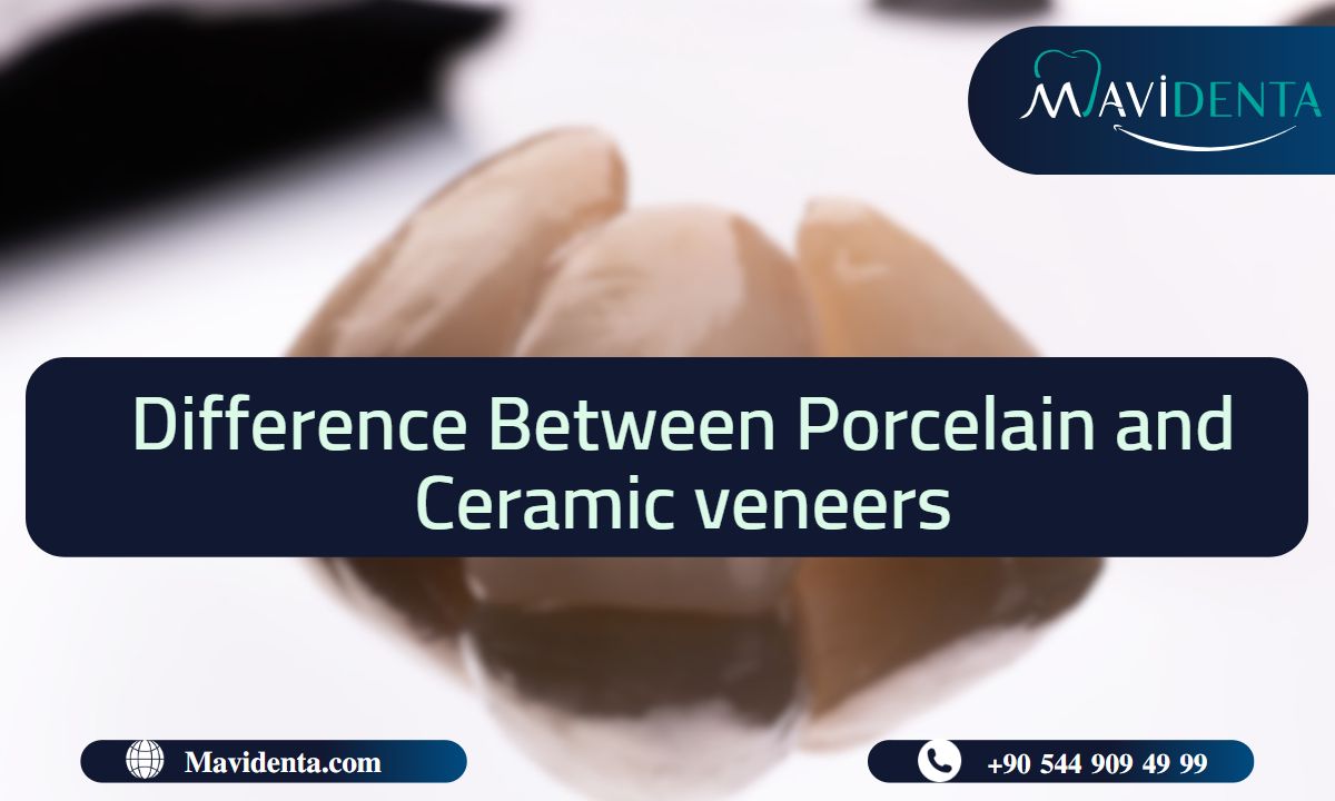 difference between porcelain and ceramic veneers