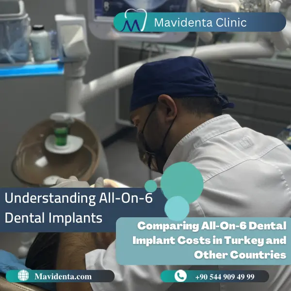 All On 6 Dental Implants Cost in Turkey All On 6 Dental Implants Cost in Turkey