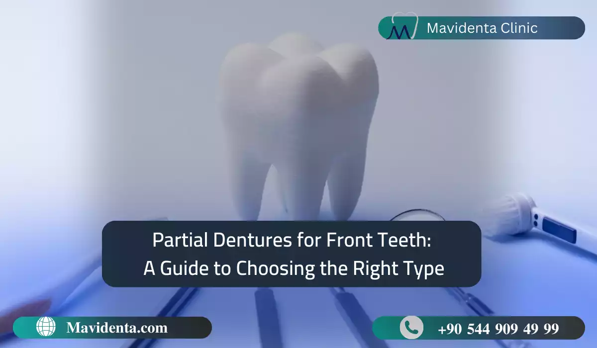 Partial Dentures for Front Teeth