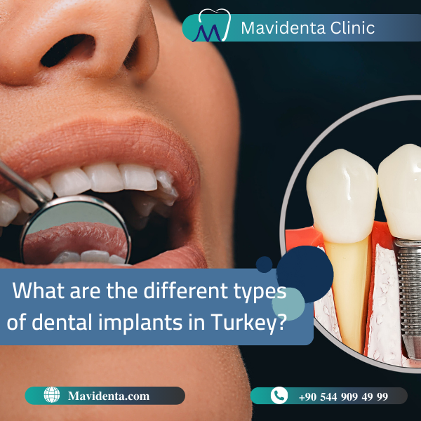 Teeth Replacement Options In Turkey