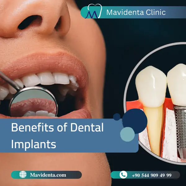 Dental Implants Problems Side Effects Dental Implants Problems Side Effects