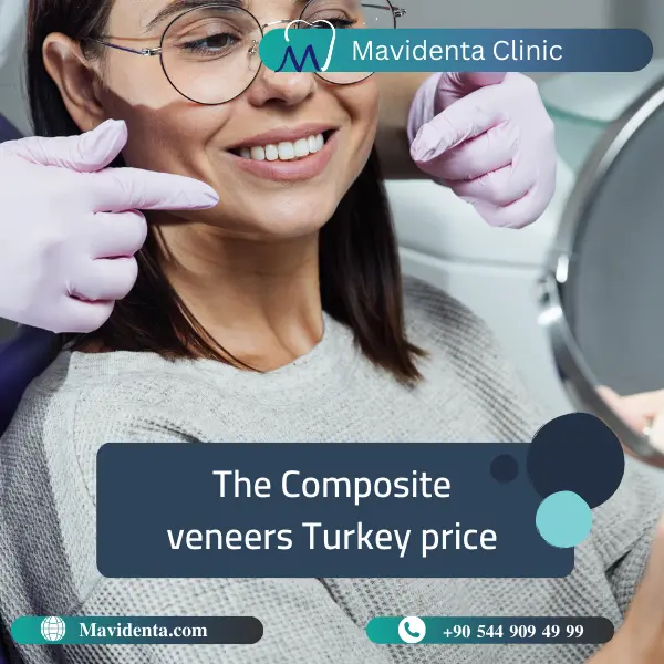 Composite Veneers Turkey Price