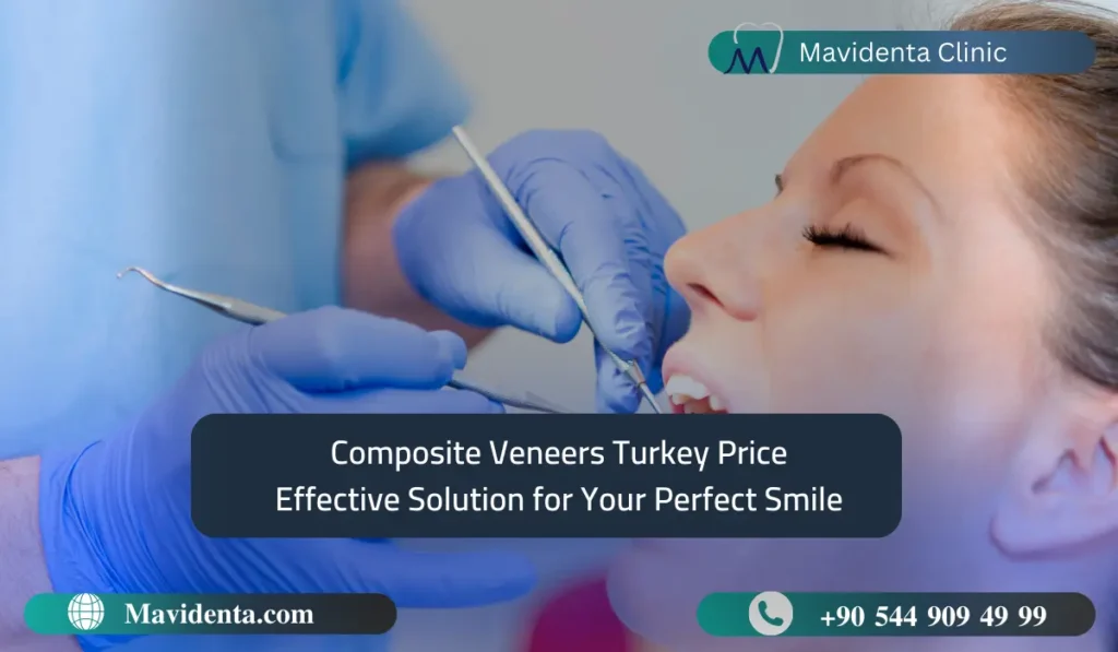 Composite Veneers Turkey Price