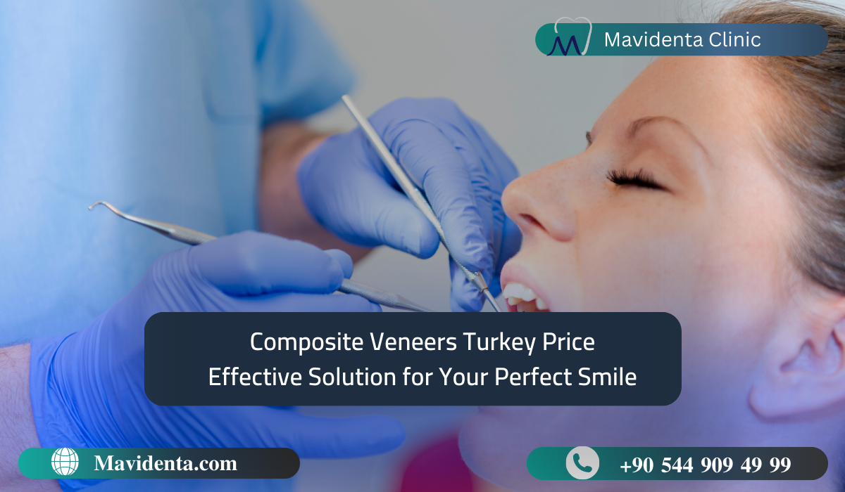 Composite Veneers Turkey Price Effective Solution for Your Perfect Smile