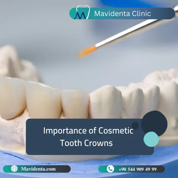 Cosmetic Tooth Crown Cosmetic Tooth Crown