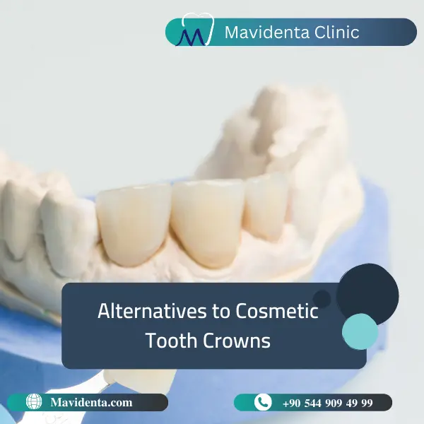 Cosmetic Tooth Crown Cosmetic Tooth Crown