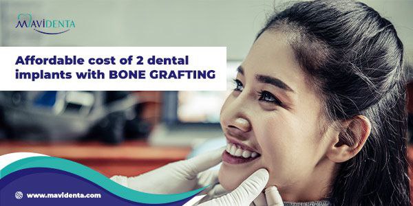 Cost Of 2 Dental Implants with Bone Grafting