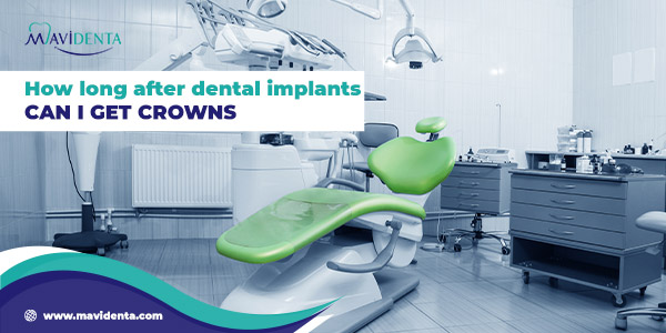 How long after dental implants can i get crowns