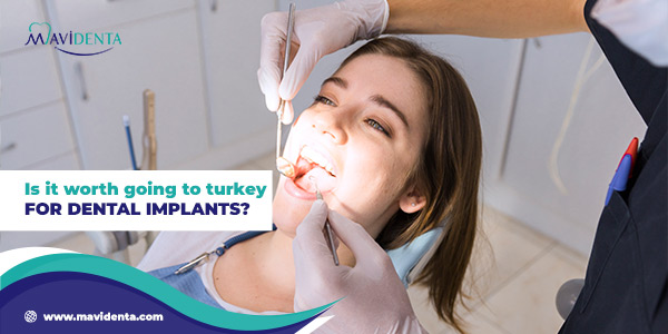 is it worth going to turkey for dental implants