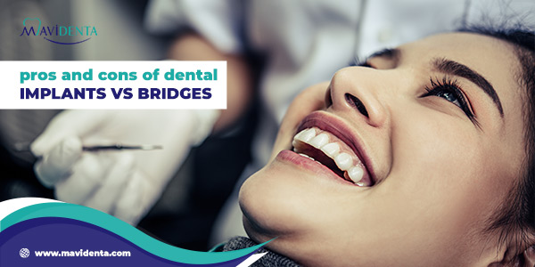 pros and cons of dental implants vs. bridges