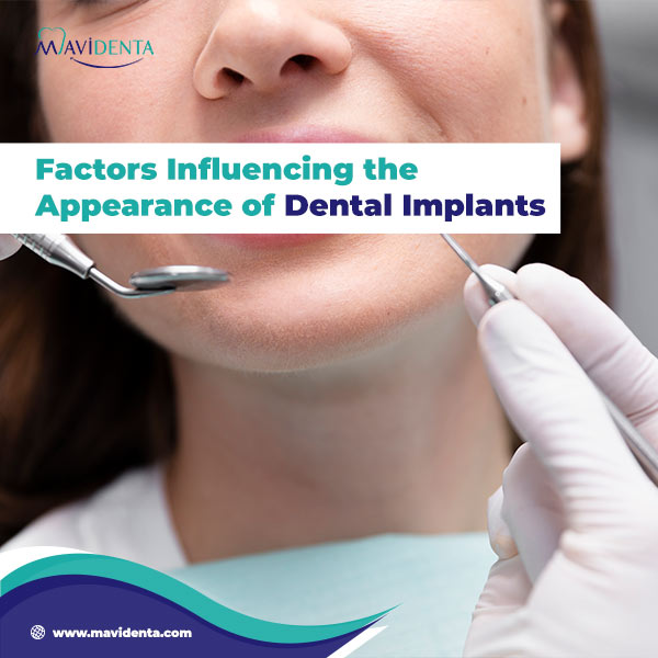 Factors Influencing The Appearance Of Dental Implants