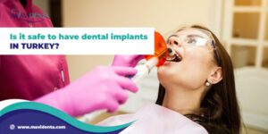 Is it safe to have dental implants in turkey ?