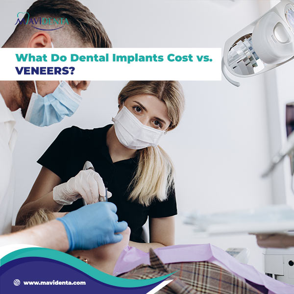 What Do Dental Implants Vs. Veneers Cost 