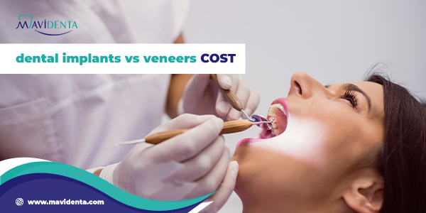 dental implants vs veneers cost