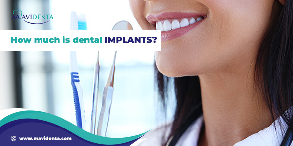 How much is dental implants?