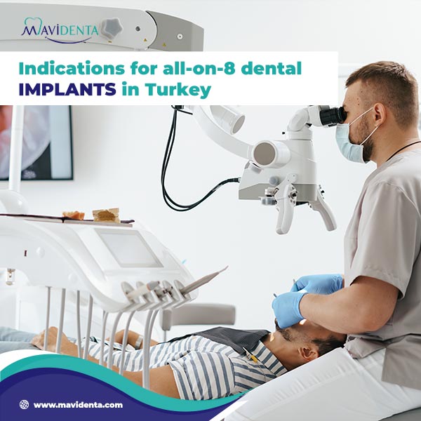 Indications For All-On-8 Dental Implants In Turkey