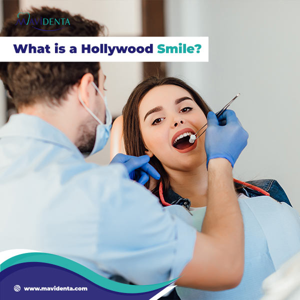Hollywood Smile Dental Price