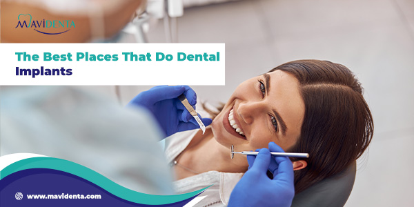 The Best Places That Do Dental Implants