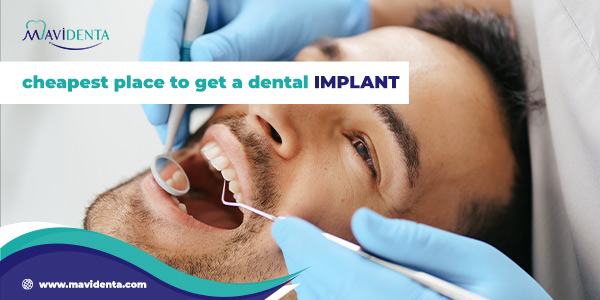 cheapest place to get a dental implant