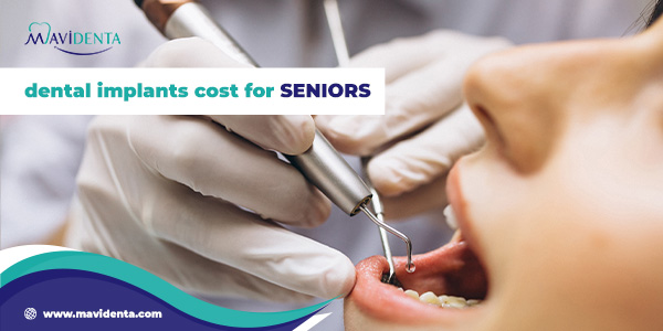 dental implants cost for seniors