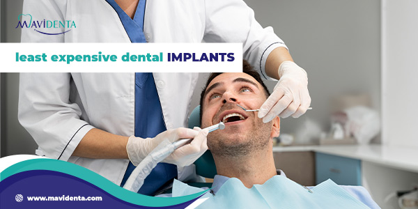 least expensive dental implants