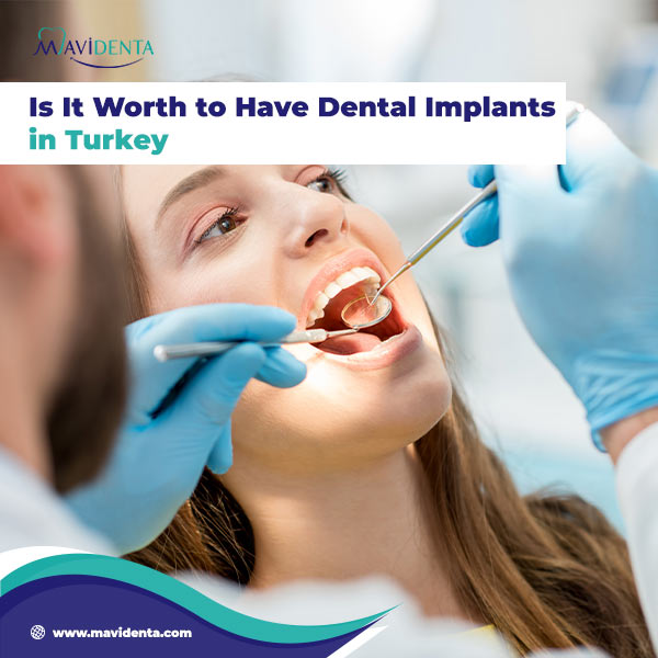 Best Place To Have Dental Implants