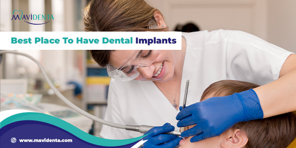 best place to have dental implants