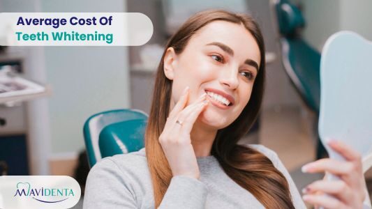 Average Cost Of Teeth Whitening